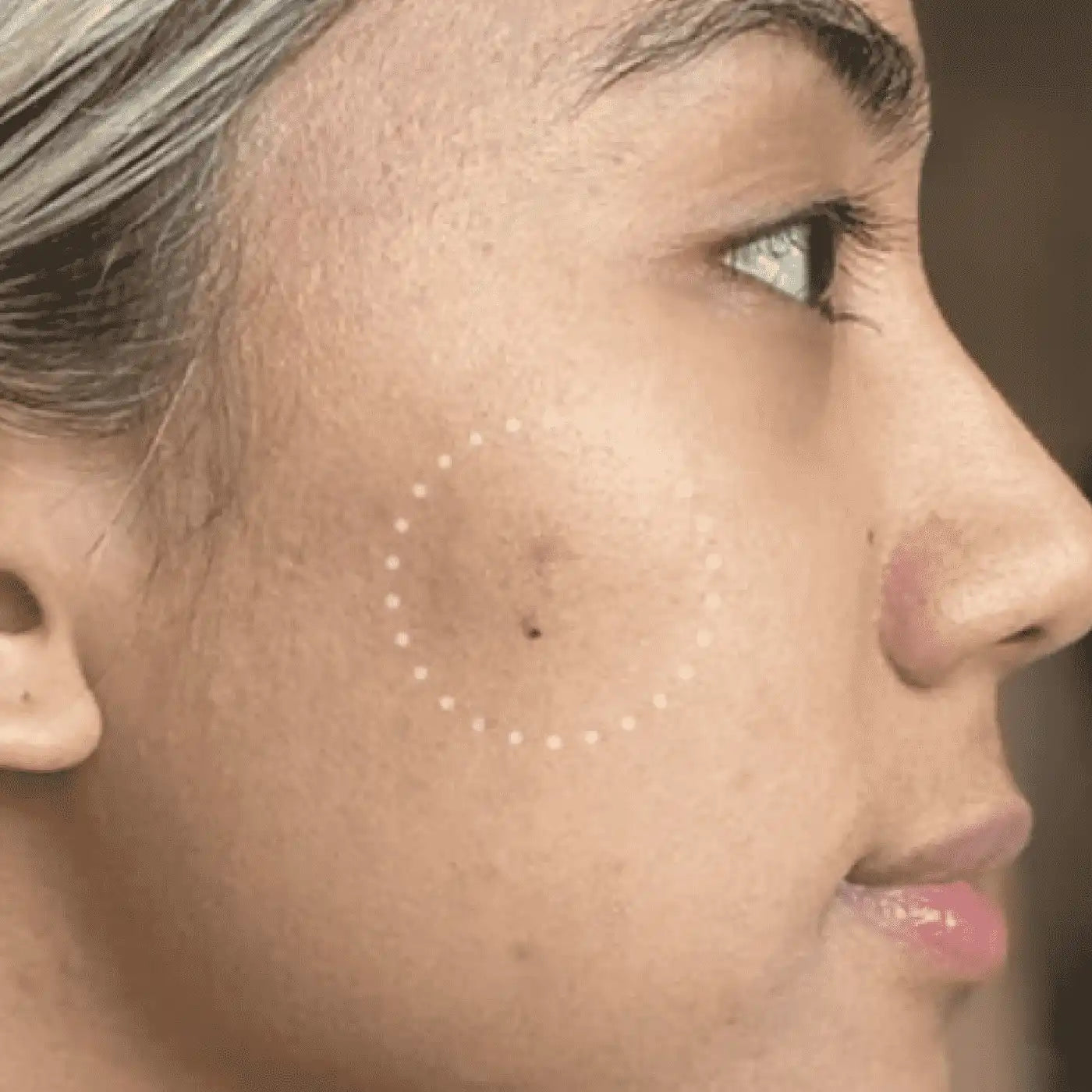 Mighty Patch™ for Dark Spots